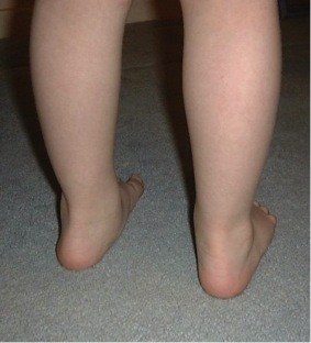 Mobile flat foot deals